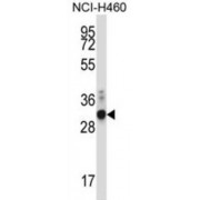 Zinc Finger Protein-Like 1 (ZFPL1) Antibody