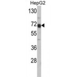 Alpha-Fetoprotein (AFP) Antibody