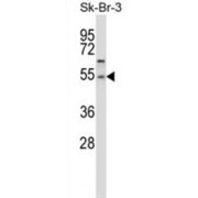 Protein Phosphatase, Mg2+/Mn2+ Dependent 1A (PPM1A) Antibody