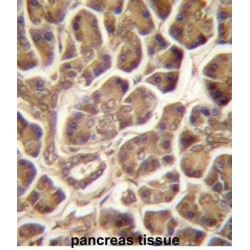 Cold Shock Domain-Containing Protein C2 / PIPPIN (CSDC2) Antibody