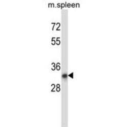 Putative Deoxyribonuclease TATDN1 (TATDN1) Antibody