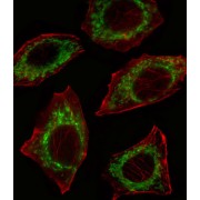 abx027970