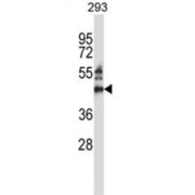 Zinc Finger Protein 660 (ZNF660) Antibody