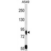 Mucin And Cadherin-Like Protein (MUPCDH) Antibody