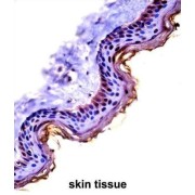 Cystatin A (CSTA) Antibody