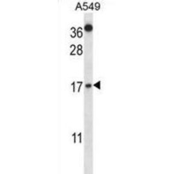 Cystatin A (CSTA) Antibody