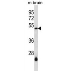 SWI/SNF-Related Matrix-Associated Actin-Dependent Regulator of Chromatin Subfamily B Member 1 (SMARCB1) Antibody