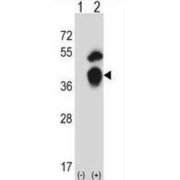 General Transcription Factor IIB (GTF2B) Antibody