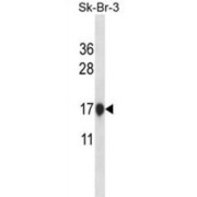 Cystatin-B (CSTB) Antibody