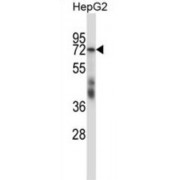 Steroidogenic Factor 1 (SF1) Antibody