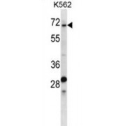 Radical S-Adenosyl Methionine Domain Containing 2 (TRIP10) Antibody