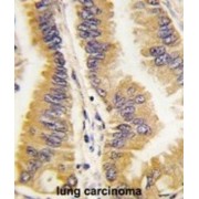 Frequently Rearranged In Advanced T-Cell Lymphomas 1 (FRAT1) Antibody