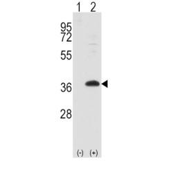 Frequently Rearranged In Advanced T-Cell Lymphomas 1 (FRAT1) Antibody