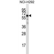 GDNF Family Receptor Alpha 2 (GFRA2) Antibody