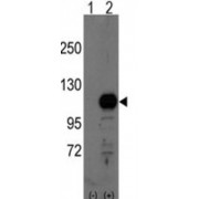 Breast Carcinoma Amplified Sequence 3 (BCAS3) Antibody
