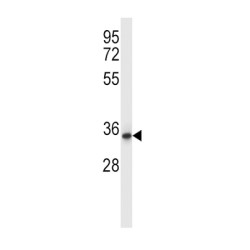 Quinolinate Phosphoribosyltransferase (QPRT) Antibody