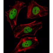 Forkhead Box D1 (FOXD1) Antibody