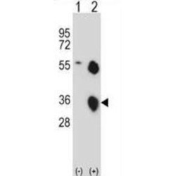 Kallikrein 8 (KLK8) Antibody