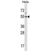 Minor Histocompatibility Antigen H13 (HM13) Antibody