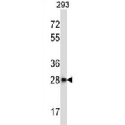CTD Small Phosphatase Like Protein 2 (CTDSP2) Antibody
