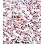 Calcipressin-3 (RCAN3) Antibody