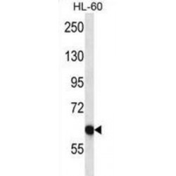 Serine/threonine-Protein Phosphatase With EF-Hands 2 (PPEF2) Antibody