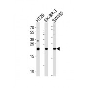 Heart And Neural Crest Derivatives Expressed Protein Protein 1 (HAND1) Antibody