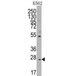 T-Cell Surface Glycoprotein CD8 Beta Chain (CD8B) Antibody