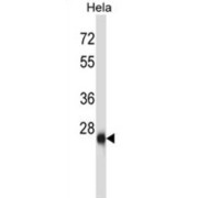 Zinc Finger Protein ZIC 4 (ZIC4) Antibody