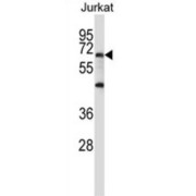 WB analysis of Jurkat cell lysates (35 μg/lane). PRDM6 antibody detection shown by the arrow.