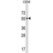 Muscarinic Acetylcholine Receptor M2 (CHRM2) Antibody
