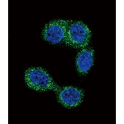 Histamine N-Methyltransferase (HNMT) Antibody