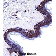 Desmoglein 1 (DSG1) Antibody