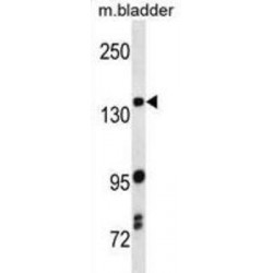 Mitogen-Activated Protein Kinase Kinase Kinase 5 (Map3k5) Antibody