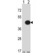 Mitogen-Activated Protein Kinase 13 (MAPK13) Antibody