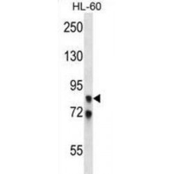 A-Kinase Anchor Protein 4 (AKAP4) Antibody