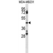 abx028094