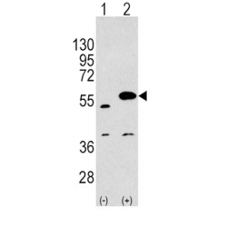 Sprouty-Related, EVH1 Domain-Containing Protein 1 (SPRED1) Antibody
