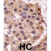 Proteasome Subunit Alpha Type 5 (PSMA5) Antibody