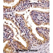 Pleckstrin Homology-Like Domain Family A Member 2 (PHLDA2) Antibody