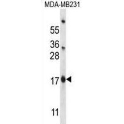 Pleckstrin Homology-Like Domain Family A Member 2 (PHLDA2) Antibody