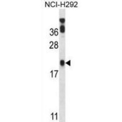 p53 Apoptosis Effector Related To PMP-22 (PERP) Antibody