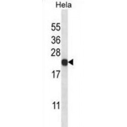 Proteasome Subunit Beta Type 5 (PSMB5) Antibody