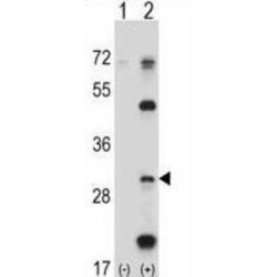 Proteasome Subunit Beta Type 5 (PSMB5) Antibody