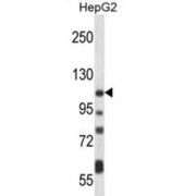 Plasma Membrane Calcium-Transporting ATPase 4 (ATP2B4) Antibody