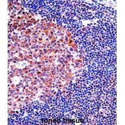 Minichromosome Maintenance Deficient 4 (MCM4) Antibody