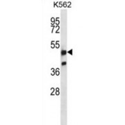 Nuclear Factor Erythroid 2-Related Factor 1 (NFE2L1) Antibody