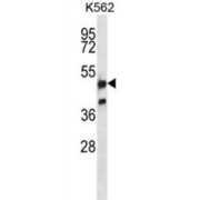 Nuclear Factor Erythroid 2-Related Factor 1 (NFE2L1) Antibody