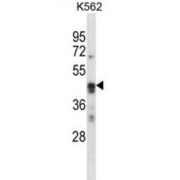 Activity-Regulated Cytoskeleton-Associated Protein (ARC) Antibody