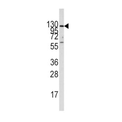 Insulin Degrading Enzyme (IDE) Antibody
